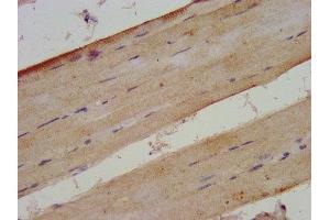 IHC image of ABIN7175925 diluted at 1:300 and staining in paraffin-embedded human skeletal muscle tissue performed on a Leica BondTM system. (XIRP2 anticorps  (AA 2861-3004))