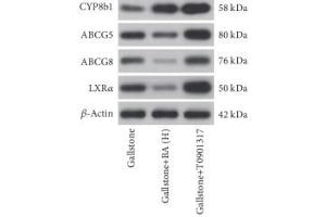 The protein levels of CYP7a1, CYP8b1, ABCG5, ABCG8 (ABIN3022643), and LXRα were measured by western blot.