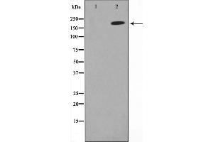 Western blot analysis on A549 cell lysate using MAGI2 Antibody,The lane on the left is treated with the antigen-specific peptide. (MAGI2 anticorps  (N-Term))