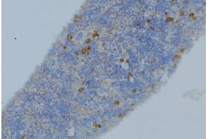 ABIN6276451 at 1/100 staining Human lymph node tissue by IHC-P.