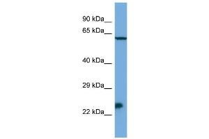 anti-Homeobox, Msh-Like 3 (MSX3) (N-Term) antibody