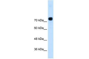 WB Suggested Anti-ACTN4  Antibody Titration: 0.