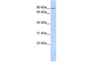 WB Suggested Anti-NCAPH Antibody Titration:  0. (NCAPH anticorps  (N-Term))