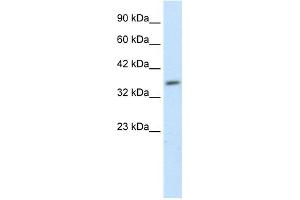 WB Suggested Anti-HEYL Antibody Titration: 1. (HEYL anticorps  (N-Term))