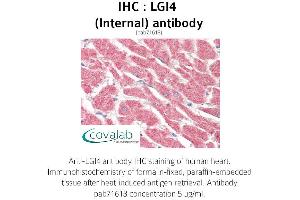 Image no. 2 for anti-Leucine-Rich Repeat LGI Family, Member 4 (LGI4) (Internal Region) antibody (ABIN1736431)