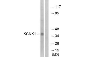 Western blot analysis of extracts from Jurkat cells, using KCNK1 antibody. (KCNK1 anticorps  (C-Term))