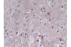 IHC-P analysis of Rat Spinal cord Tissue, with DAB staining. (PF4 anticorps  (AA 30-105))