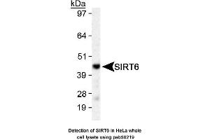 Image no. 1 for anti-Sirtuin 6 (SIRT6) (AA 300-355), (C-Term) antibody (ABIN363528) (SIRT6 anticorps  (C-Term))