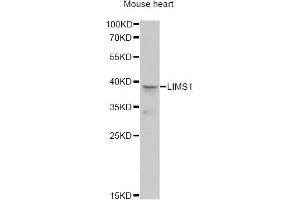 Western blot analysis of extracts of mouse heart, using LIMS1 antibody (ABIN6293172) at 1:1000 dilution. (LIMS1 anticorps)