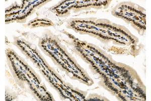 ABIN6264528 and ABIN6266732 at 1/100 staining Mouse colorectal tissue by IHC-P. (PTTG1 anticorps  (Internal Region))