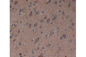 Used in DAB staining on fromalin fixed paraffin- embedded brain tissue (GABRA2 anticorps  (AA 42-250))