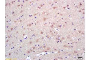 Formalin-fixed and paraffin embedded rat brain labeled with Rabbit Anti Trk A/B/C Polyclonal Antibody, Unconjugated (ABIN726095) at 1:200 followed by conjugation to the secondary antibody and DAB staining (TrkA, B, C (AA 668-750) anticorps)