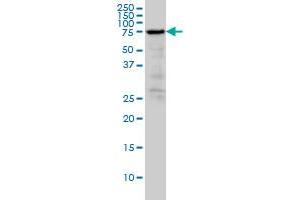 RDX monoclonal antibody (M03A), clone 1F6 Western Blot analysis of RDX expression in A-431 . (Radixin anticorps  (AA 1-583))