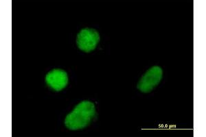 Immunofluorescence of purified MaxPab antibody to ZNF131 on Daoy cell. (ZNF131 anticorps  (AA 1-510))