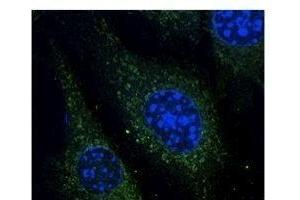 Anti-Rab14 Ab at 1/500 dilution, lysates at 50 µg per Iane, rabbit polyclonal to goat lµg (HR?