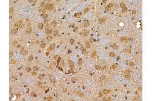 ABIN6257637 and ABIN6274779 at 1/100 staining Rat brain tissue by IHC-P. (RPL34 anticorps)