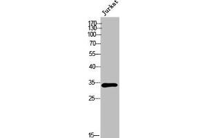 Western Blot analysis of Jurkat cells using Olfactory receptor 6P1 Polyclonal Antibody