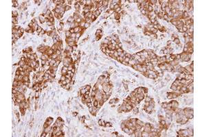 IHC-P Image Immunohistochemical analysis of paraffin-embedded A549 xenograft, using LRP(MVP), antibody at 1:500 dilution.