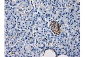 Immunohistochemical staining of paraffin-embedded liver tissue using anti-HDAC10mouse monoclonal antibody. (HDAC10 anticorps)
