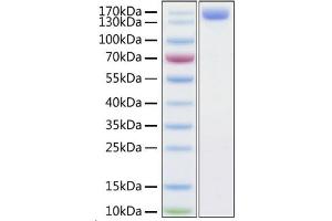 Recombinant Human ACE2 Protein was determined by SDS-PAGE with Coomassie Blue, showing a band at 140-150 kDa