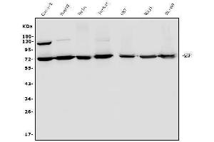 Western blot analysis of SENP1 using anti-SENP1 antibody (ABIN7600422).