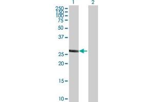 Western Blot analysis of SULT1A1 expression in transfected 293T cell line by SULT1A1 MaxPab polyclonal antibody.