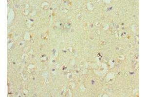 Immunohistochemistry of paraffin-embedded human brain tissue using ABIN7148555 at dilution of 1:100 (ATP7B anticorps  (AA 1166-1465))