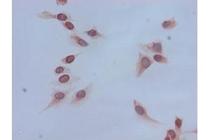 Immunocytochemistry analysis of Hela cells using ABIN7139167 at dilution of 1:100