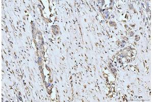 IHC analysis of MOV10 using anti-MOV10 antibody (ABIN7600236). (MOV10 anticorps  (AA 167-772))