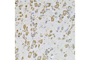 Immunohistochemistry of paraffin-embedded mouse brain using CYBB antibody. (CYBB anticorps)
