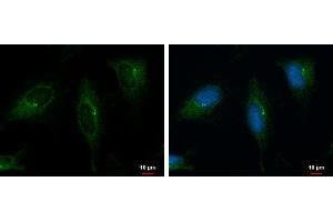 ICC/IF Image PKD2 antibody [C1C3] detects PKD2 protein at cytoplasm by immunofluorescent analysis.