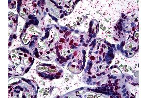 Anti-ARID3A antibody IHC of human placenta. (ARID3A anticorps  (AA 317-417))