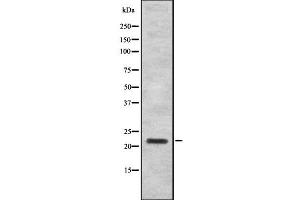 Western blot analysis IFN16 using K562 whole cell lysates