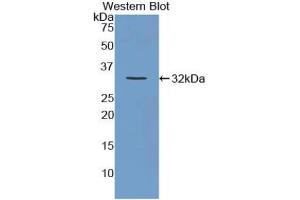 Detection of Recombinant Versican, Mouse using Polyclonal Antibody to Versican (VCAN)