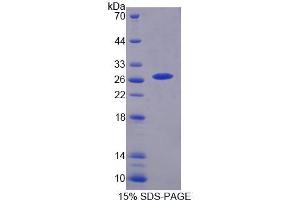 SDS-PAGE analysis of Human CHRNa3 Protein. (CHRNA3 Protéine)