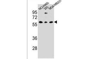 CLEC17A Antibody (C-term) (ABIN1536790 and ABIN2849828) western blot analysis in NCI-,293,MDA-M cell line lysates (35 μg/lane). (CLEC17A anticorps  (C-Term))