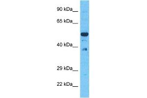 Host:  Rabbit  Target Name:  EVI2B  Sample Type:  293T Whole Cell lysates  Antibody Dilution:  1. (EVI2B anticorps  (C-Term))