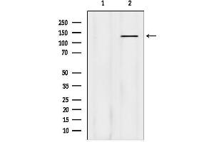 Western blot analysis of lysates from HepG2 cells, using Phospho-Abl (Tyr204) Antibody.
