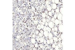 IHC analysis of TRMT61A using anti-TRMT61A antibody (ABIN7599220). (TRMT61A anticorps  (AA 1-289))