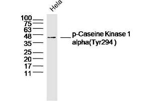 Hela lysates probed with Casein Kinase 1 alpha (Tyr294) Antibody, Unconjugated  at 1:300 dilution and 4˚C overnight incubation. (CSNK1A1 anticorps  (pTyr294))
