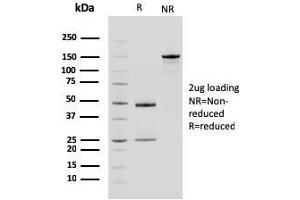 SDS-PAGE Analysis Purified Carboxypeptidase A1 / CPA1 Mouse Monoclonal Antibody (CPA1/2714).