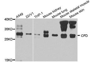 Western blot analysis of extract of various cells, using CFD antibody. (Adipsin anticorps)