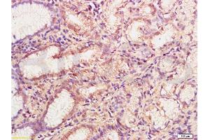Formalin-fixed and paraffin embedded human gastric mucosa labeled with Anti-MMP-3 Polyclonal Antibody , Unconjugated at 1:200, followed by conjugation to the secondary antibody and DAB staining