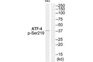 Western blot analysis of extracts from COLO cells using ATF-4 (Phospho-Ser219) Antibody. (ATF4 anticorps  (pSer219))