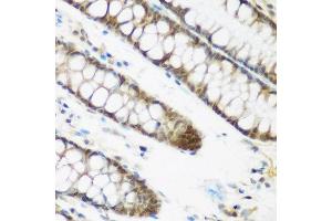 Immunohistochemistry of paraffin-embedded human colon using NCBP2 antibody at dilution of 1:200 (40x lens). (NCBP2 anticorps)