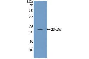 Western blot analysis of recombinant Mouse Iga. (CD79a anticorps  (AA 30-193))