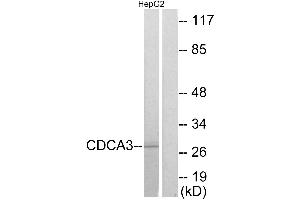 Immunohistochemistry analysis of paraffin-embedded human colon carcinoma tissue using CDCA3 antibody. (CDCA3 anticorps)