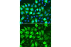 Immunofluorescence analysis of A549 cells using RRM2 antibody (ABIN5973030).