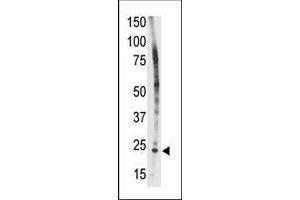 The anti-Bid BH3 domain Pab (ABIN388099 and ABIN2846183) is used in Western blot to detect Bid BH3 in HL-60 cell lysate. (BID anticorps  (AA 68-103))