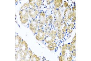 Immunohistochemistry of paraffin-embedded human stomach using BNIP3L antibody (ABIN5973708) at dilution of 1/100 (40x lens).